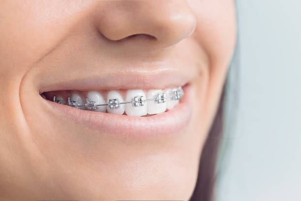 Best Invisalign and Clear Aligners  in Oneonta, NY